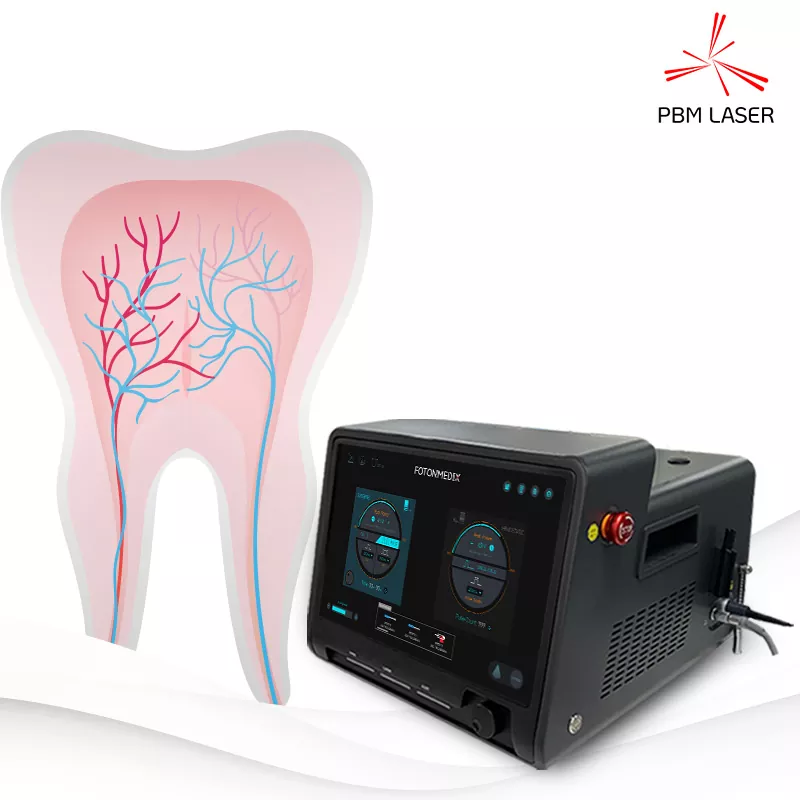 Laser chirurgical dentar